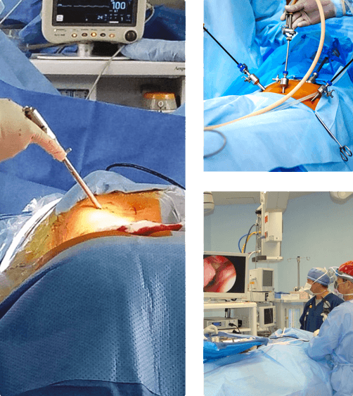 CaSES surgeons operating with laparoscopic instruments in theatre